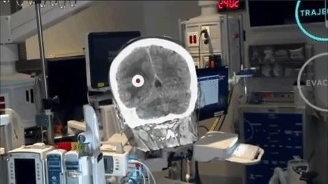 Medical Software Maker Medivis Closes $2.3 Million in Funding to Bring HoloLens to Surgical Platform